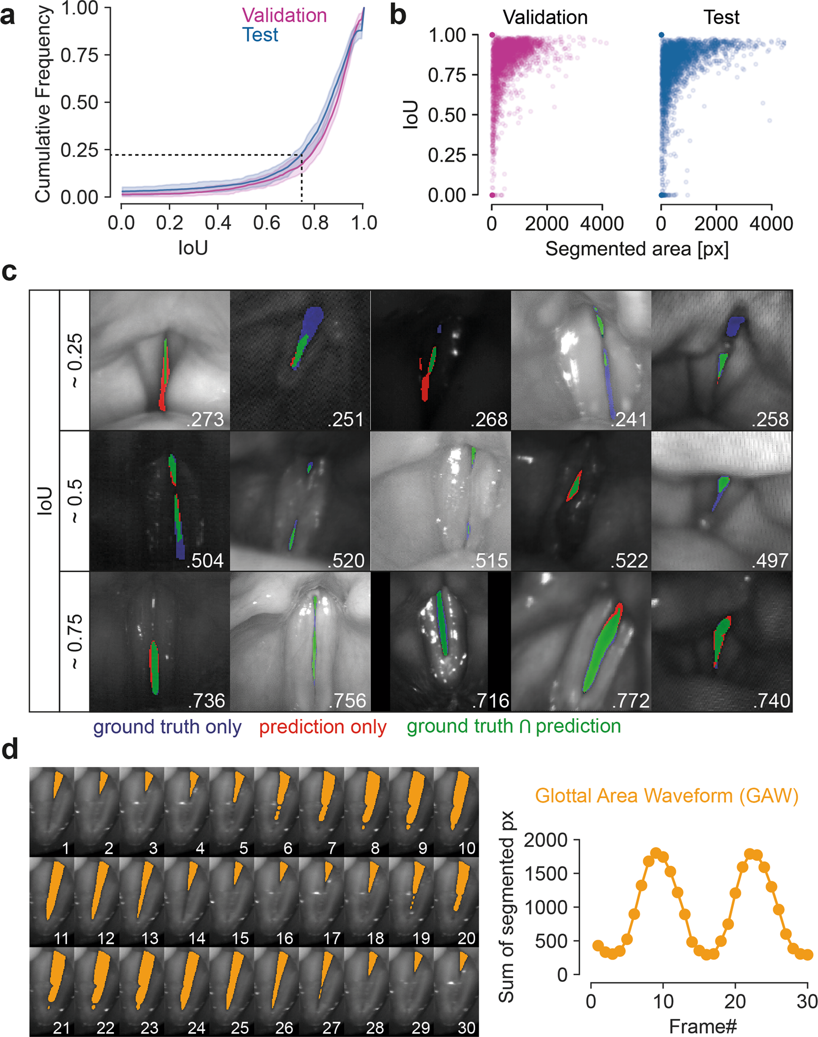 BAGLS glottis segmentation results